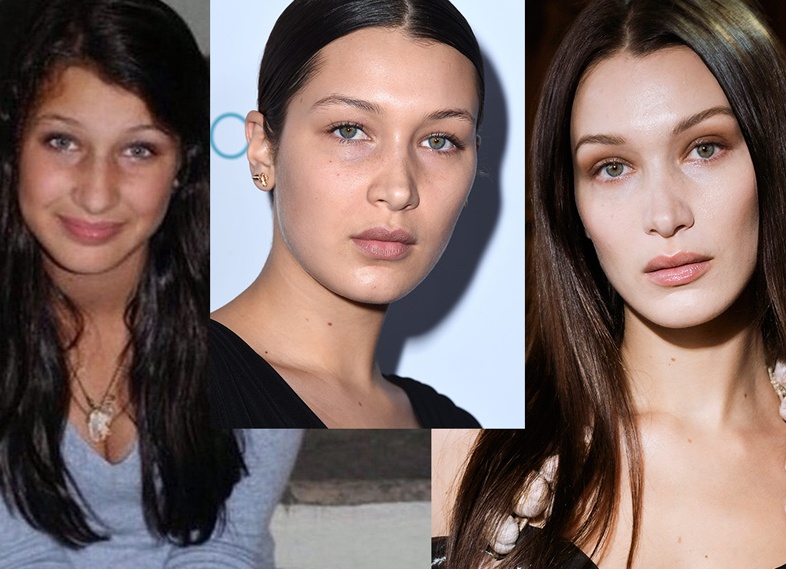 Какие новые операции сделают Беллу Хадид еще идеальнее от ушей до пальцев ног