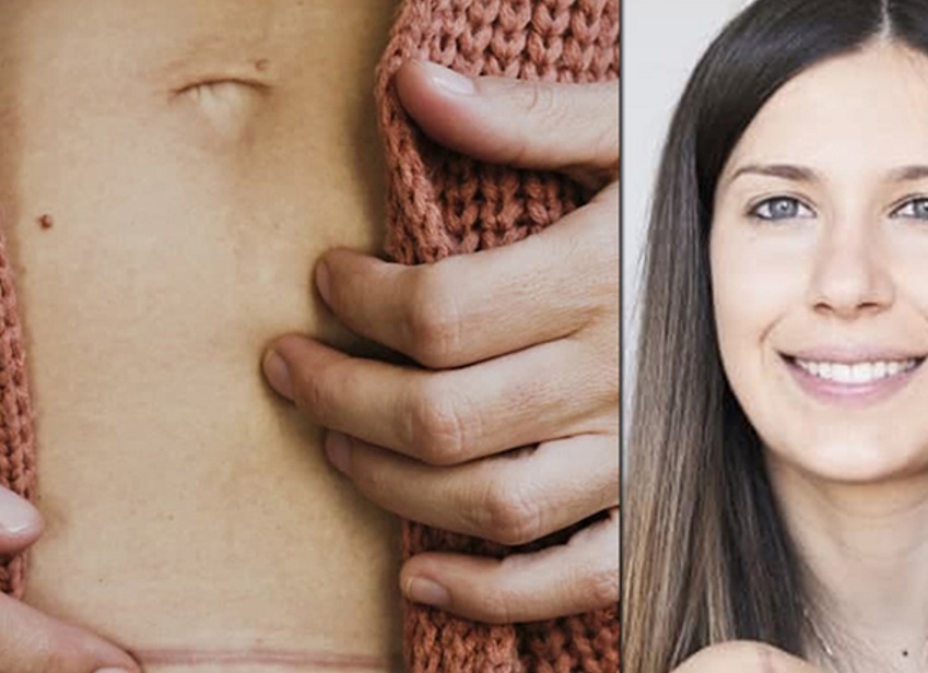 Как избавиться от шрамов и рубцов гид по эффективным методикам