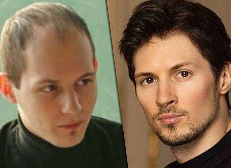 Пользователи Сети уверены что Павел Дуров сделал наращивание или пересадку волос