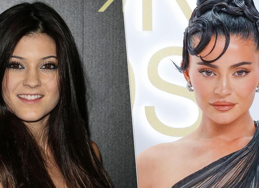 Кайли Дженнер хочет отменить всю свою пластику врач ответил реально ли это